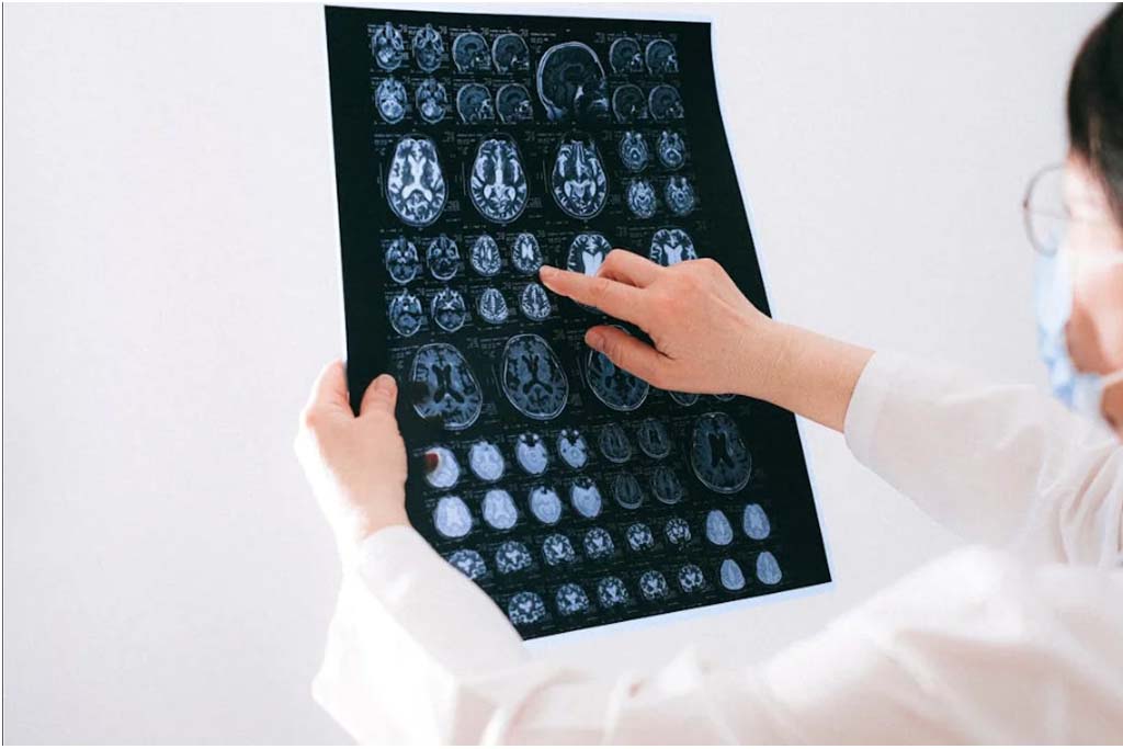Neurology Department